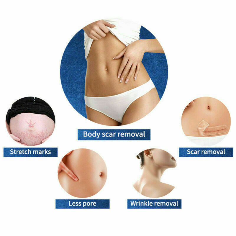 Newest M8 RF Microneedle Machine Skin Tightening Wrinkle Removal Face Lift Bidy Stretch mark removal